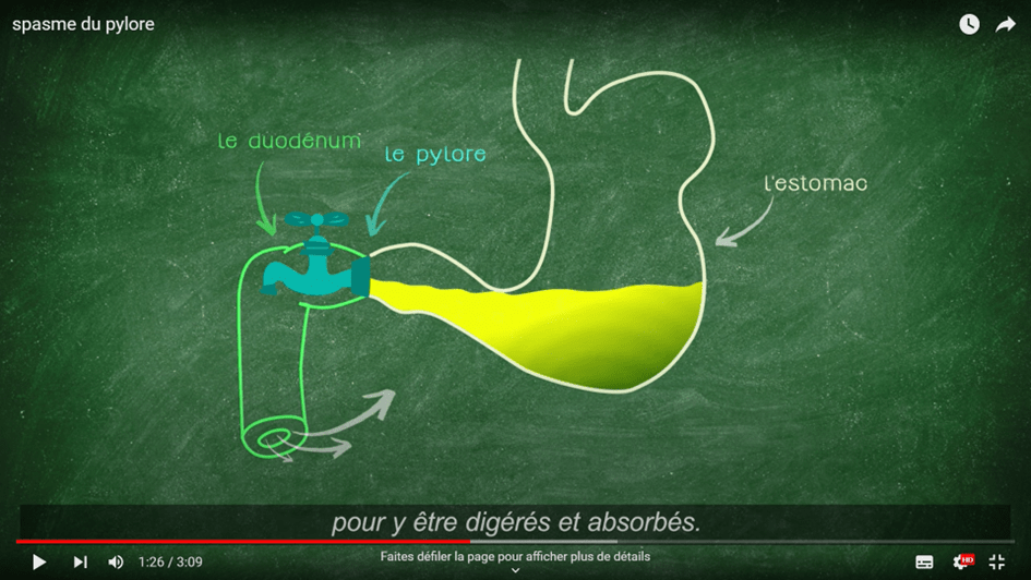 Vidéo : Tout savoir sur les spasmes du pylore, les reflux gastro-œsophagiens (RGO)et ses traitements en&nbsp;étiopathie